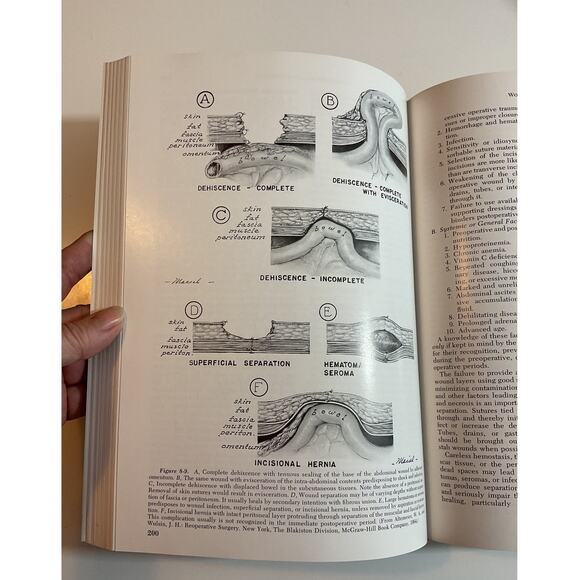1971 Hardback Critical Surgical Illness by James D. Hardy - Picture 8 of 8
